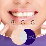 Hismile Color Corrector V34, Clareador Dental Sem Peróxido